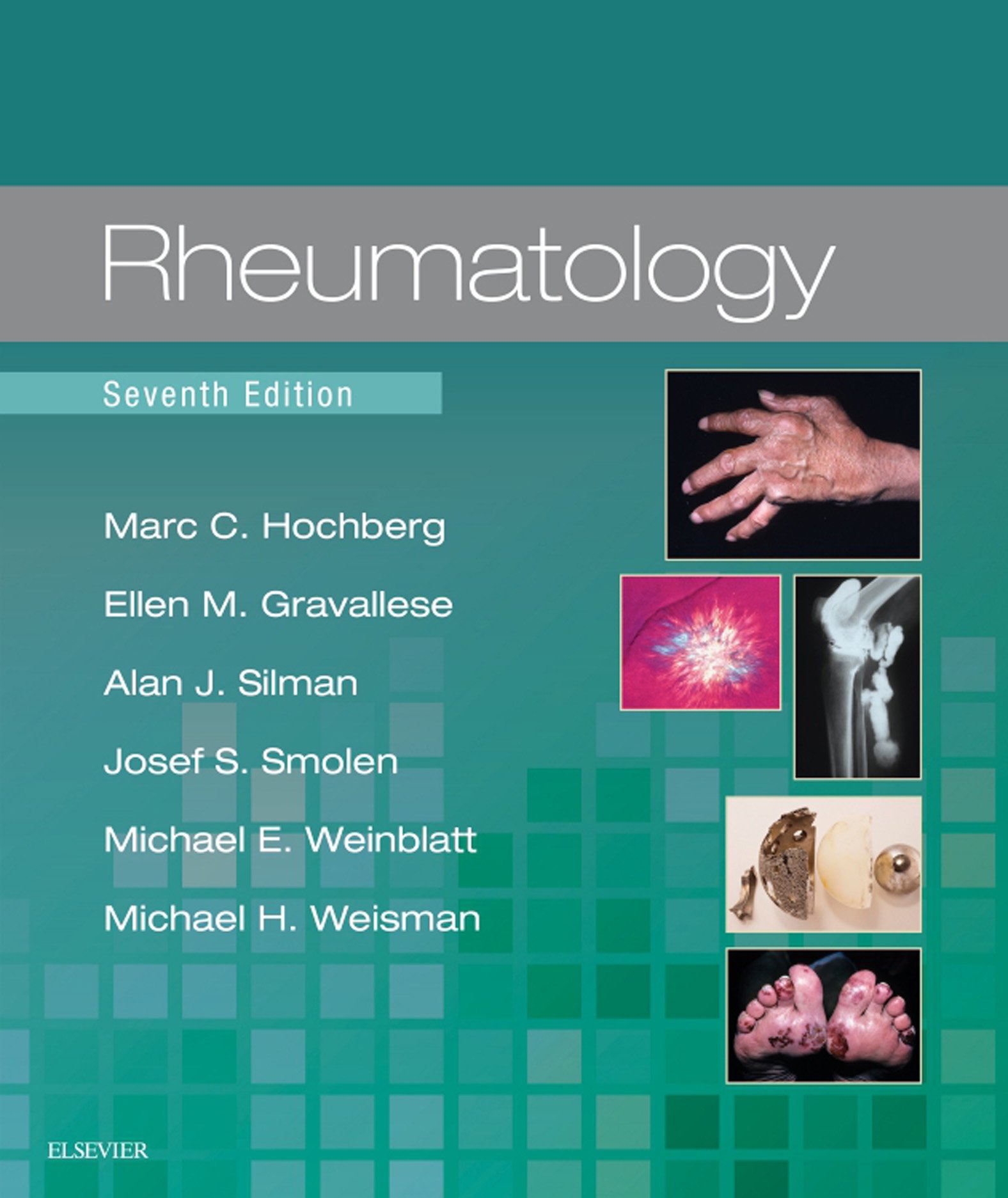 Rheumatology, 7th Edition